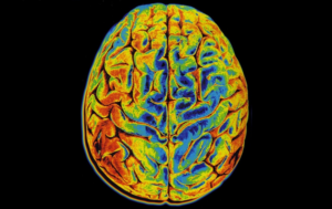 Surgery Monitoring San Antonio