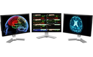Neuro Monitoring San Antonio